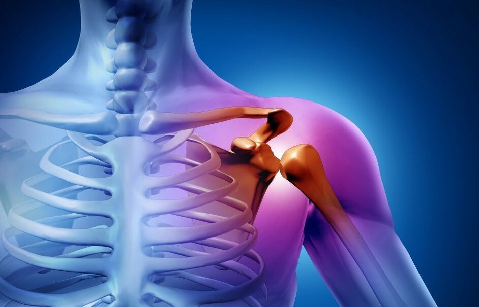 травма плечевого сустава вследствие артроза